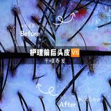 中医养发㊙️向脱发姐妹安利这家店❗❗ 