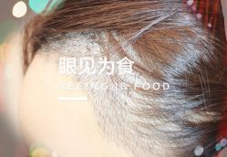 -大麦微针植发全国连锁