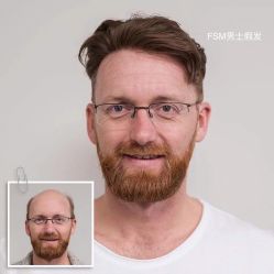 -发饰美男士增发补发假发定制店