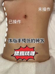 -Fundi张玉珊修身堂·indiba·BTL科技瘦身