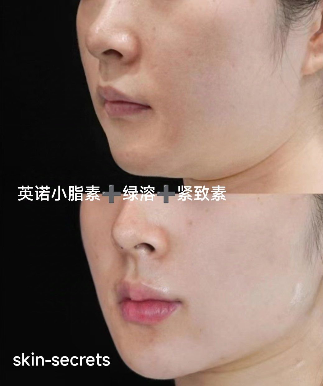 英诺小脂素77绿溶对抗双下巴和口角囊袋77紧致素