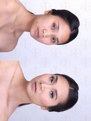 -清疣美疣·痣·斑净肤中心