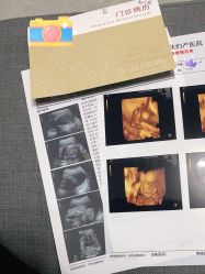 -上海百佳妇产医院