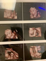 -杭州贝瑞斯美华妇儿医院·早孕·产检·儿科