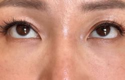 -Yestar 嘉兴艺星医疗美容医院