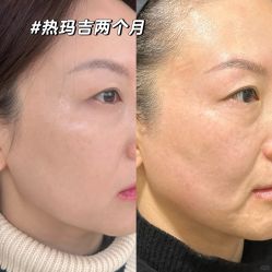-上海伊莱美医疗美容医院