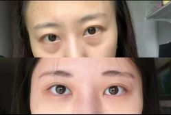 点击看大图 -郡艺医疗美容·微整·眼鼻吸脂