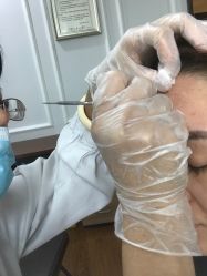 -洁铭新加坡医美