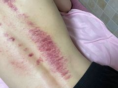 -沈师傅盲人按摩工作室(密三小区店)