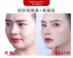 -上海时光整形外科医院