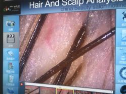 -雍禾植发全国连锁