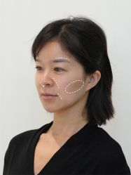 -Yestar艺星医疗美容医院
