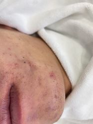 -蕾特恩专业祛痘·皮肤管理