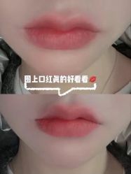 -广州美莱医疗美容医院