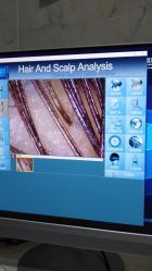 点击看大图 -雍禾植发全国连锁