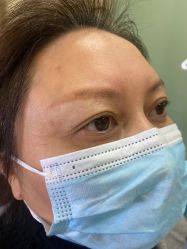 点击看大图 体验前-重庆联合丽格第五医疗美容医院