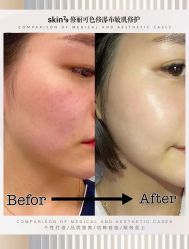-skin79皮肤管理中心