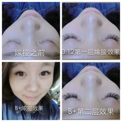 iphone_upload_pic-光SPA科技美肤