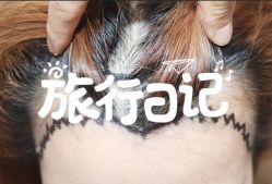 -大麦微针植发全国连锁