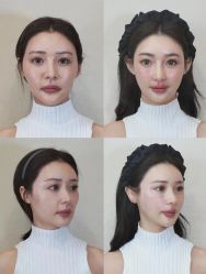 -上海伊莱美医疗美容医院