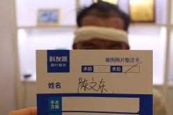 -大麦微针植发丨全国连锁