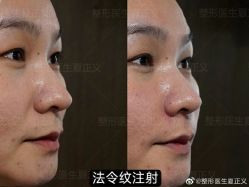 -北京米扬丽格医疗美容·联合丽格鼻整形中心