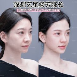 -深圳艺星医疗美容医院