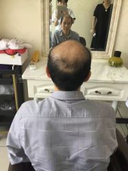 -唐风采假发补发定制