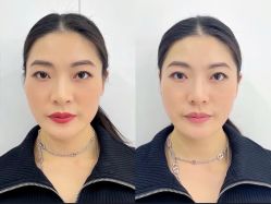 -上海伊莱美医疗美容医院