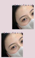 点击看大图 -变美丽半永久纹眉连锁·机器野生眉•洗眉