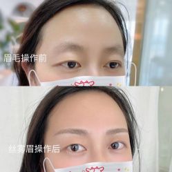 点击看大图 -Verywang半永久纹眉•仪器野生眉