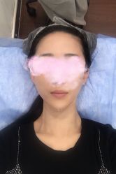 -澳尔颜选医疗美容