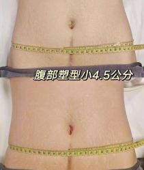 -Lily纤美·科技减脂中心