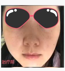 体验前-苏州卫康美容医院