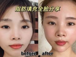-温州伯思立医院