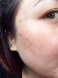 英树玻尿酸羊胎素化妆品-英树玻尿酸羊胎素专营化妆品