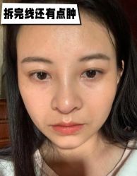 -素美医疗美容·西南眼鼻整形·修复基地