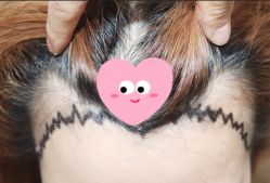 -大麦微针植发全国连锁