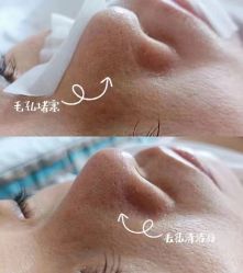 -LUNA皮相美·骨相美高级美感