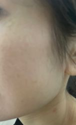 -广州美莱医疗美容医院