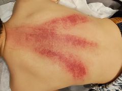 -承启堂中医馆·推拿·针灸(成华馆)