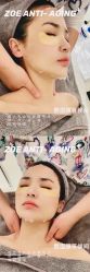 -紫御国际抗衰ZOE ANTI AGING