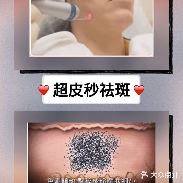 祛斑精华or祛斑霜，是智商税吗？