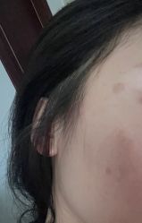 体验前-小忠丽格医美