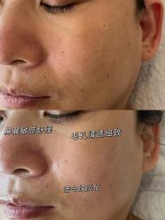 -美肤盾祛痘·问题肌头疗管理中心