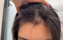 -熙朵美学植发·连锁品牌