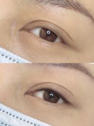 -德绣·机器野生眉发际线·美瞳线半永久