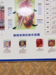 -瑶芳·痘院士专业祛痘·皮肤管理