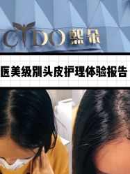 体验前-熙朵美学植发连锁