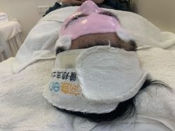 -痘院长·祛痘·皮肤管理